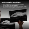 DeltaHub Ergonomski oslonac za zglob Carpio 2.0 - ergonomic wrist rest Left / L / White
